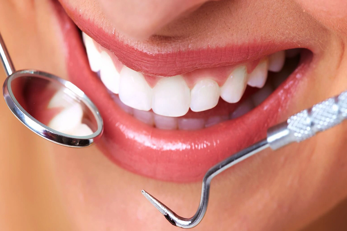 Popular Types of Cosmetic Dentistry