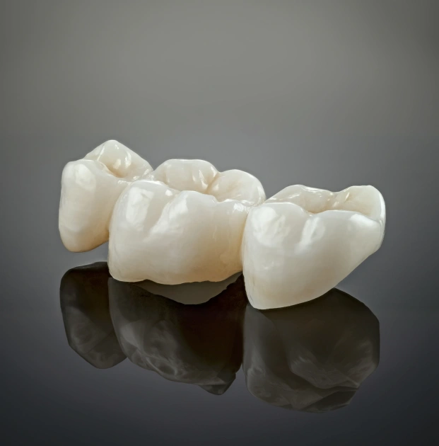 img-crowns-bridges